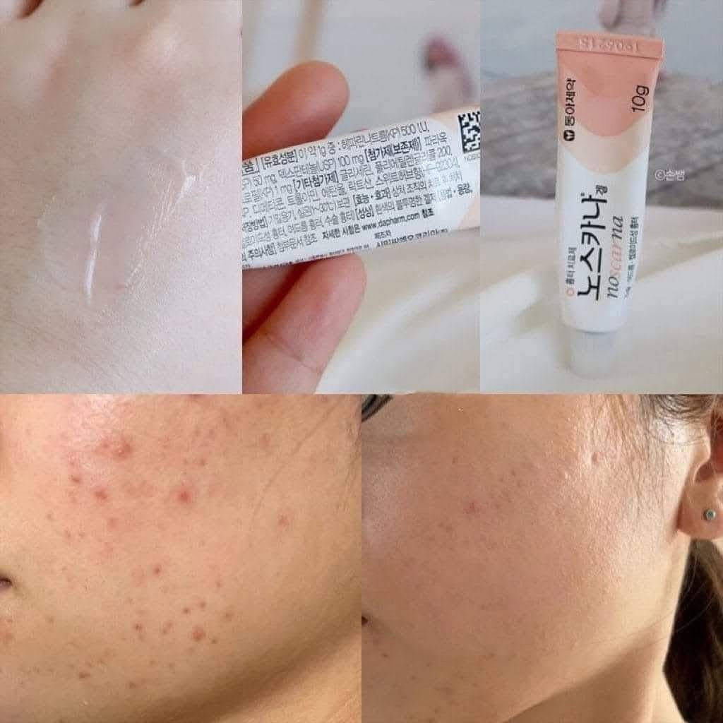 Noscarna Gel 20g