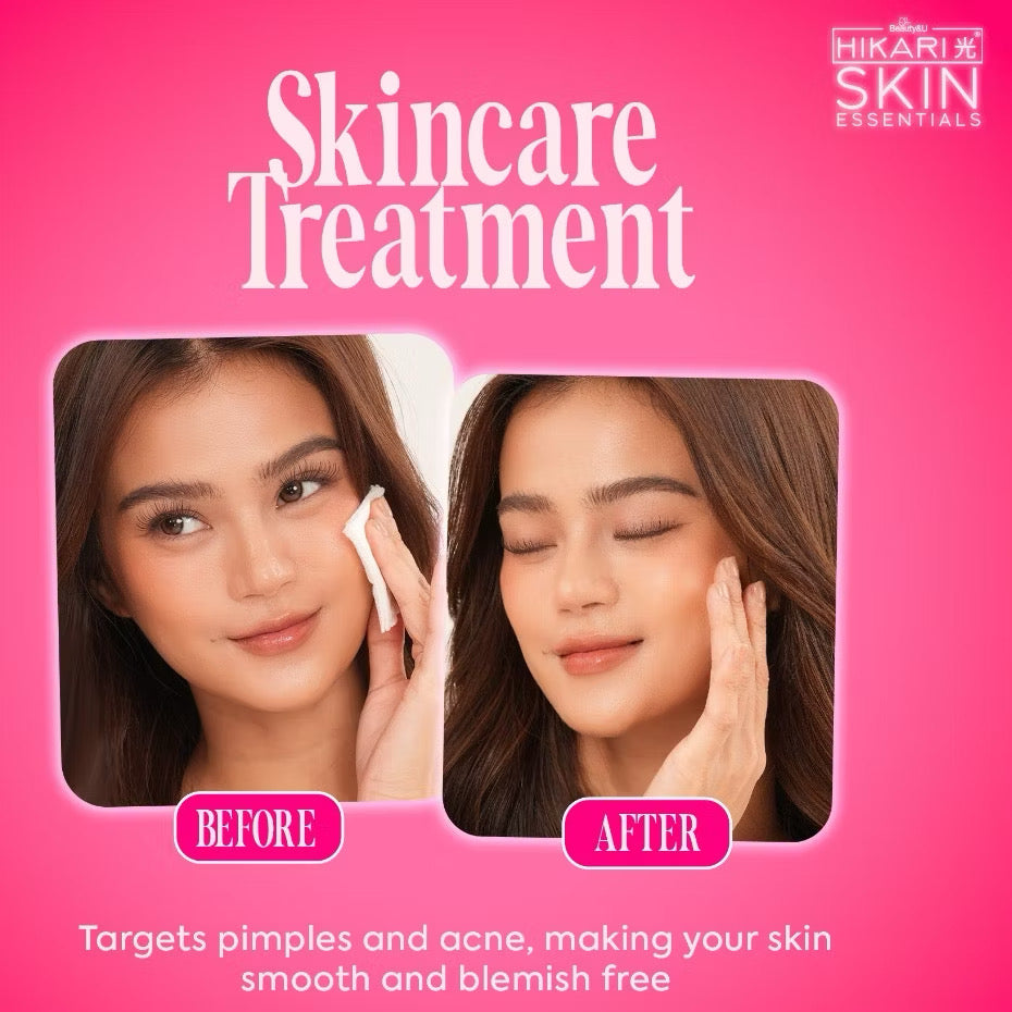 Ultra white rejuvenating set by hikari skin essentials for brightening and acne control